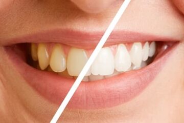 whiten teeth naturally